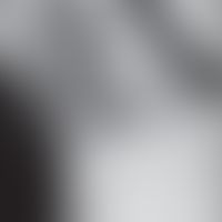 Soorösophagitis radiologischer Befund: entommen aus: Mohamed AA et al. (2019) Diagnosis and Treat...