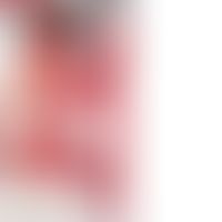 Harlequin discoloration: Characteristically, there are strictly hemiplegic flat erythema with sha...
