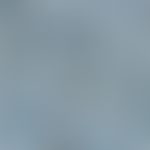 Histoplasma capsulatum: multiple pathogens in the tissue; isolated typical macroconidia (Grocott-...
