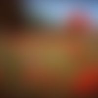 Klatschmohn: Blüten und noch unreife, grüne Kapselfrüchte.

