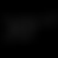 Dopamine: structural formula
