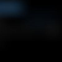 Acetylcholine: Synthesis of acetylcholine from choline and acetyl-CoA, catalysed by acetylcholine...