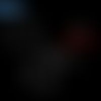 Biperids: Structural formula of biperids
