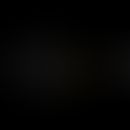 Structural formula of benzocaine (ester-type local anaesthetic)
