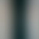 Urticarial dermographism (ruber): red stripes after light rubbing with a wooden spatula in a 35-y...