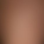 Porokeratosis superficialis disseminata actinica: disseminated, brownish-yellowish, sharply defin...