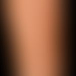 Chronischer Sonnenschaden der Haut: trockene, etwas atrophische&nbsp;Haut mit solaren Lentigines,...