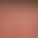Light ageing of the skin: chequered skin with small hyperpigmentations (solar lentigines).
