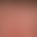 Lentigo solaris: multiple, disseminated, a few millimetres to 0.5 centimetres in size, usually bi...