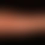 Koebner phenomenon - Eruptive xanthomes: Linear arrangement of reddish-brown papules as an expres...