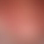 Lichtalterung der Haut: scheckige Haut mit kleinherdigen Hyperpigmentierungen (solaren Lentigines...