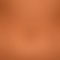 Drug reaction, fixed: suddenly appeared, reddish-brownish, roundish, sharply defined, hardly infi...