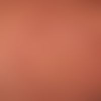 Granuloma anulare disseminatum: detailed picture. non-painful, non-itching, disseminated, large-a...