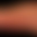 Poikilodermatische Mycosis fuungoides (Plaque-Typ): auffällige läsionale Atrophie, die dem klinsi...