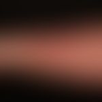Sézary Syndrome: universal redness with small-focus recesses. small spotted scaling. massive itch...