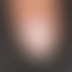 Leuconychia striata: Weiße Querstreifen in der Nagelplatte des Fingernagels nach Manikürschaden (...