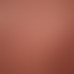 Nappes claires: almost erythrodermic poicolodermatic form of mycosis fungoides, splashes of light...