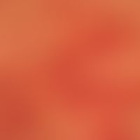 Lupus erythematosus chronicus discoides: a relapsing, progressive, disseminated, scarring, chroni...