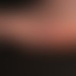 Melanom malignes akrolentiginöses: Seit vielen Jahren bestehender brauner "Fleck" an der linken K...