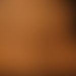 Acanthosis nigricans benigna: unscharf begrenzte braun-schwarze Flecken und Plaques. Die Plaques ...