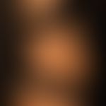 Acanthosis nigricans (benigna): generalisiertes Krankheitsbild mit großflächigen, unscharf begren...