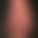 Chronische Handdermatitis: flächige chronische Dermatitis der Handrücken und der Fingerzwischenrä...