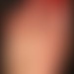 Dyshidrotische Dermatitis: chronisch rezidivierende,&nbsp; hyperkeratotische Dermatitis&nbsp; an ...