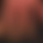 psoriasis of the hands: here partial manifestation of generalized psoriasis. hyperkeratotic plaqu...