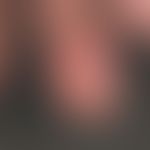 Fingerkuppennekrose des Digitus III bei einer 52-jährigen Patientin mit progressiver systemischer...