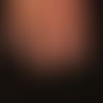 Thrombangiitis obliterans: decades of nicotine abuse. 12 months of acrozynosis (even more severe ...