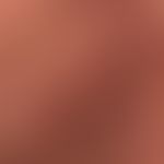Differenzialdiagnose Sarkoidose der Haut: vorliegend eine anuläre granulomatöse Entzüdnung bei Sp...