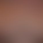 Mononucleosis infectious: acutely occurring, little itchy, maculo-papular exanthema, accompanied ...