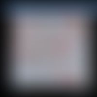 TAM: Tumorparenchym mit Makrophagen (durch Pfeile gekennzeichnet)
