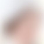 Acne conglobata: entommen aus:&nbsp;Dr. Willan Cutaneous Diseases fortgeführt von Thomas Bateman
