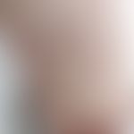 Varizellen: entnommen aus&nbsp;&nbsp;Dr. Willan, Cutaneous Diseases fortgeführt von Thomas Bateman
