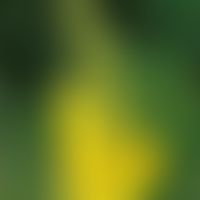 Blüten der großblütigen Königskerze (Verbascum densiflorum)
