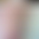 Positives Pricktestergebnise mit Polyäthylenglykolen unterschiedlicher Molekülgröße (entnommen au...