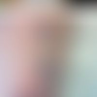 Positives Pricktestergebnise mit Polyäthylenglykolen unterschiedlicher Molekülgröße (entnommen au...