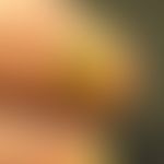 Onychogrypose: Mann, 85 Jahre. Seit Jahren bestehende Verdickung des re GZN mit typischen Querril...