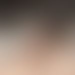 Frontal fibrosierende Alopezie, Auflichtmikroskopie:&nbsp; typische&nbsp;Einzelhaare mit&nbsp; pr...