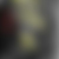 Laser Scanning Mikroskopie, Detailaufnahme, s. vorhergehende Abbildung, verdichtetes bindegewebig...