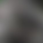 Rosazea, Laser Scanning Mikroskopie, Junktionszone, dilatierte, prominente Haarfollikel (gelb mar...
