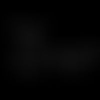 Structural formula of captopril. Captopril is not a prodrug.
