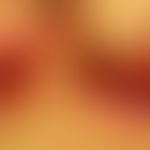 Psoriasis inversa: 85jährige Patienten, Zn schwerer exanthematischer Psoriasis vor Jahren, alles ...
