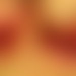 Psoriasis intertriginosa: 85 years old patients, Zn of severe exanthematic psoriasis years ago, a...