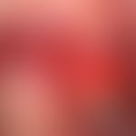 SMAS: anatomische Verhältnisse&nbsp;
