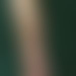 Cytostatic, cutaneous side effects: hyperpigmentation in the course of the venous system of the f...