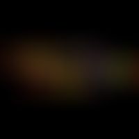 A topoisomerase unwinds the DNA molecule from complex structures of the interphase chromatin. A h...