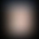 CANDLE-Syndrom: rekurrierendes multiformes Exanthem mit anulären (Kreis) und multiformen Erytheme...