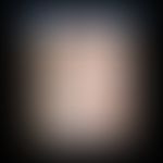 CANDLE-Syndrom: rekurrierendes multiformes Exanthem mit anulären (Kreis) und multiformen Erytheme...